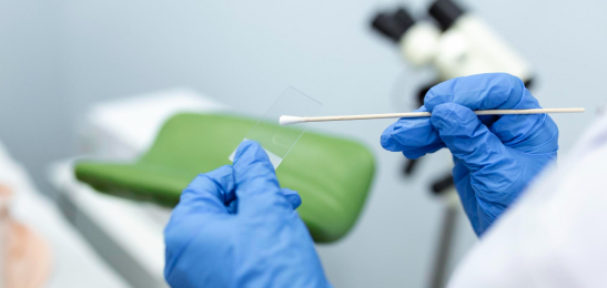 Pap Smear Test in Madhubani